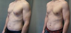chirurgien esthetique homme 94